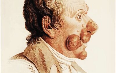 Dermatología